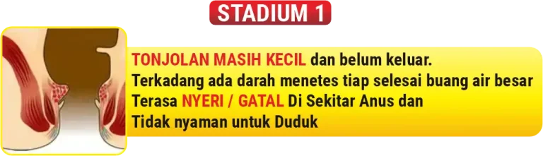 Ilustrasi Wasir stadium 1